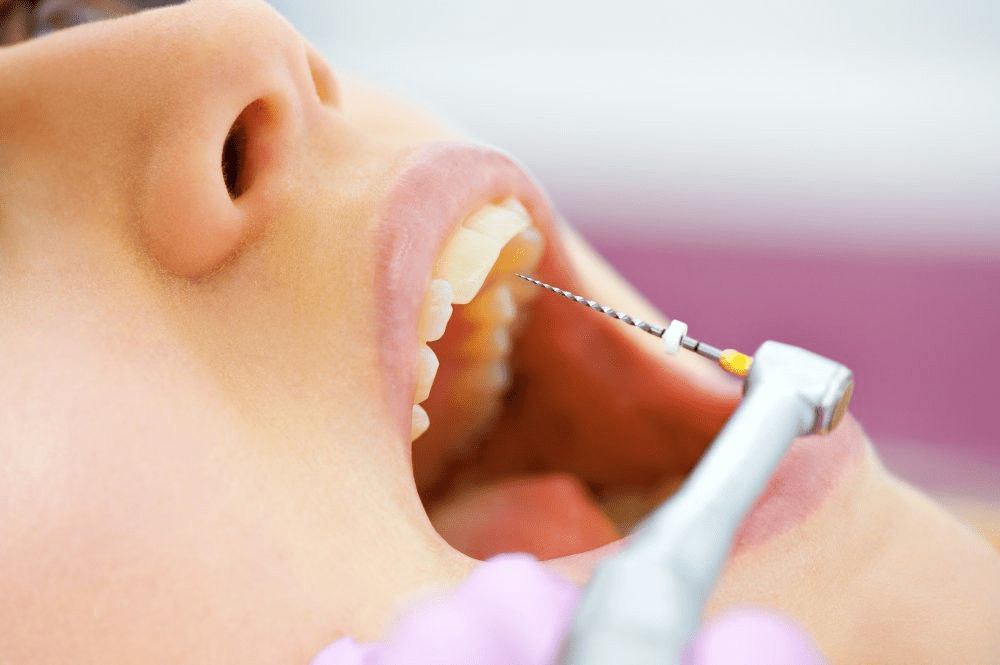 Root canal treatment